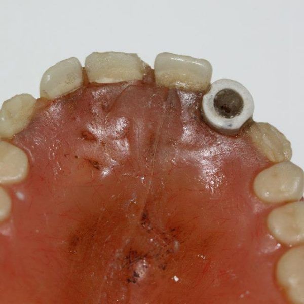 J1